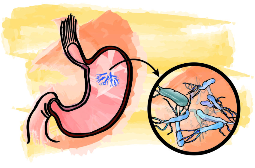  Helicobacter Pylori: la bacteria con la que convivimos a diario